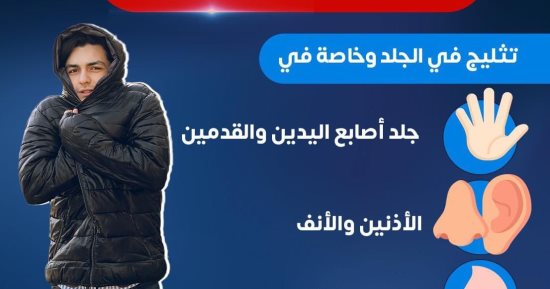 وزارة الصحة توجه رسالة هامة عن تثليج الأطراف مع انخفاض درجات الحرارة