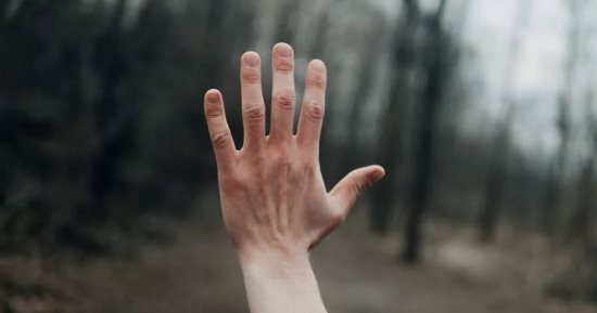 بيحس أنهم مش بتوعه.. رجل يطلب من الطبيب إزالة إصبعين سليمين من يده