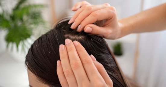7 طرق لاستخدام زيت الزيتون لمنع قشرة الرأس.. حل نهائي لمشكلة مزعجة