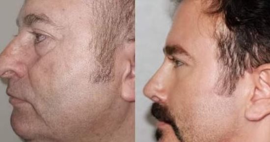 هتخرج واحد تانى.. عيادة تجميل تحظى بشعبية كبيرة فى تركيا.. "صور"