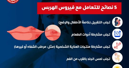 وزارة الصحة تكشف 5 نصائح مهمة للتعامل مع فيروس الهربس