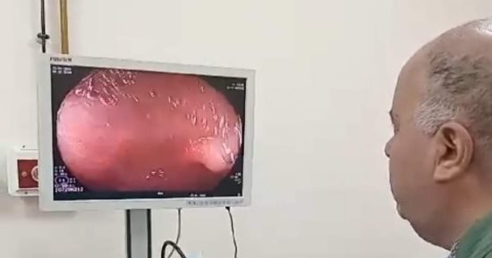 مستشفى المنصورة التخصصى ينجح فى علاج مسن بالمناظير بتكنيك دقيق نادر عالميا