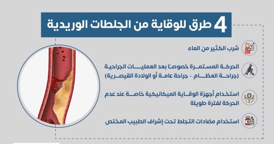 وزارة الصحة تكشف 4 طرق للوقاية من الجلطات الوريدية .. إنفوجراف