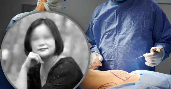 وفاة امرأة بعد خضوعها لـ6 عمليات تجميل في يوم واحد وأسرتها تطلب 168 ألف دولار تعويضًا