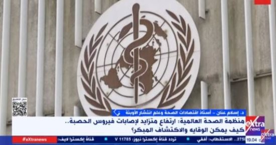 أستاذ اقتصادات الصحة: المنظومة الصحية الجيدة تساعد فى القضاء على الحصبة