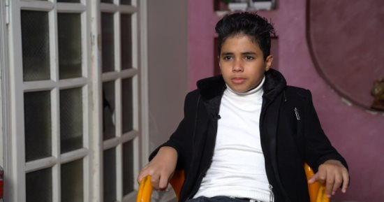إنجاز طبى الأول من نوعه بالعالم.. شفاء طفل مصاب بالسعار بسبب عضة كلب .. فيديو