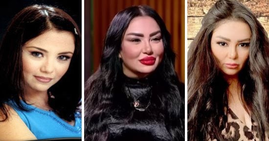إيمان أيوب لمنتقديها: مش عاملة عمليات تجميل.. فيلر بس