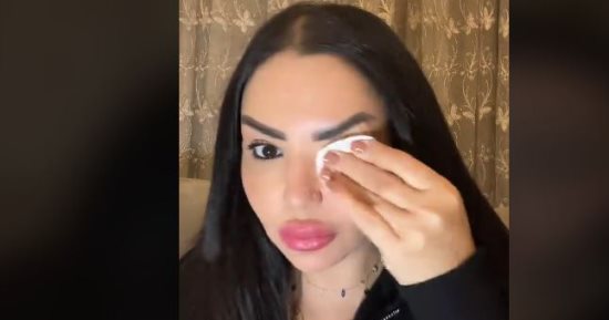 إيمان أيوب تزيل مكياجها على الهواء وتؤكد: حاقنة فيلر بالشفايف فقط