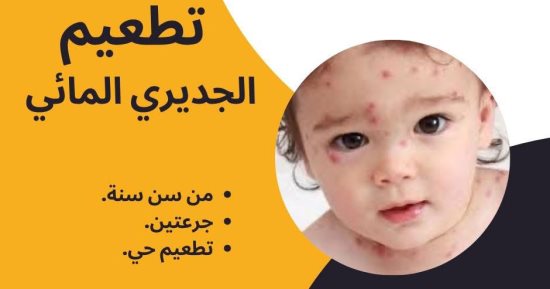 فاكسيرا: توفير تطعيم الجديرى المائى بفروع المصل واللقاح