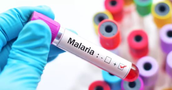 الصحة العالمية توافق على اختبار تشخيصى لدعم العلاجات الآمنة للملاريا
