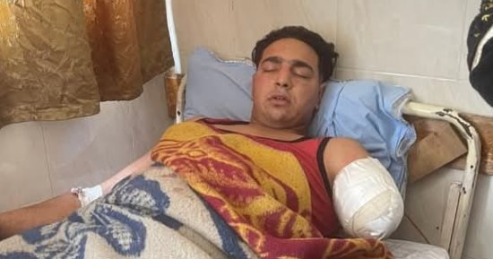 ننشر أول صورة لعامل السيرك بعد بتر ذراعه داخل مستشفى جامعة طنطا