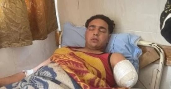 بين أنياب النمر والقانون.. اعرف الموقف القانوني لضحية السيرك بطنطا