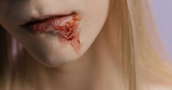 تفسير حلم بقع الدم.. 3 دلالات إيجابية و3 تحذيرات 