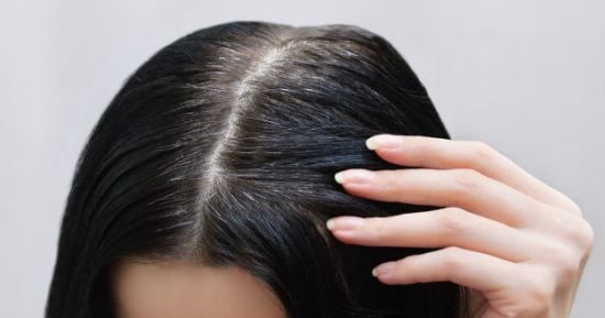 كيف يشكل النوم بشعر مبلل ضررا؟ مخاطر لا تتوقعيها 
