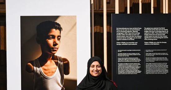 فلسطينية تفوز بجائزة الصحافة العالمية عن صورة طفل شوهته غارة إسرائيلية