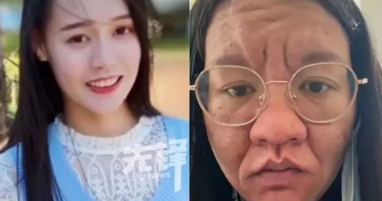 ماعرفتش نفسها فى المراية.. الحمل يتسبب فى تحول جسدي مذهل لسيدة صينية
