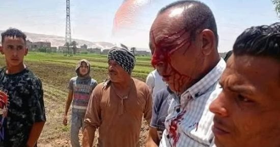 التقرير الطبى للموظف المعتدى عليه بسوهاج: انفجار مفرغ فى مقلة العين اليسرى