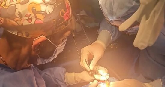 إجراء 7 عمليات زراعة قوقعة للأطفال بمستشفى الهلال للتأمين الصحى بسوهاج