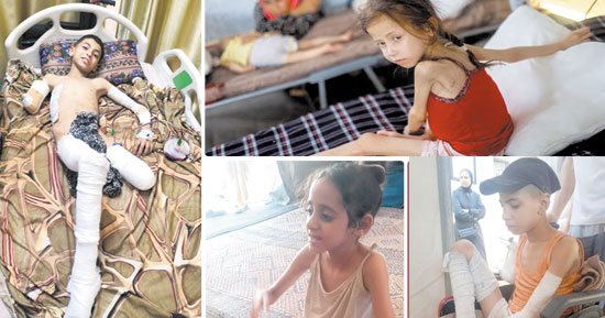 "جوعى و عطشى" المجاعة تحصد أرواح أطفال غزة.. 100 ألف طفل فلسطينى على شفا الموت.. سوء التغذية وشح الحليب يؤثران على البنية الجسدية لأطفال القطاع.. ومؤسسات حقوقية دولية توثق جرائم الاحتلال