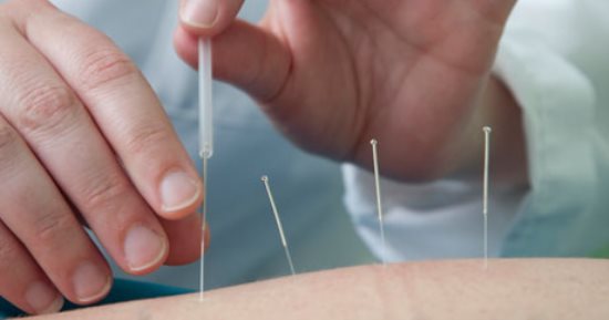 دراسة: الإبر الصينية تخفف آلام الظهر لدى كبار السن 
