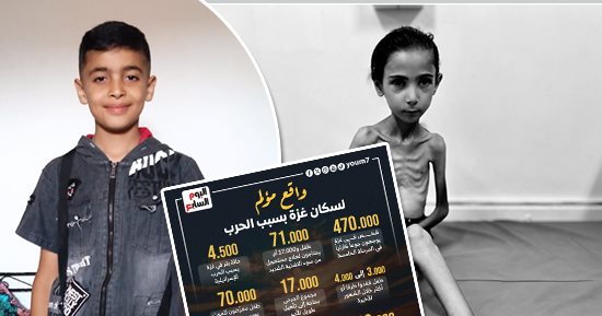 صرخات أمام عيون وقحة (1).. إيهاب فى غيبوبة بعد قصف الاحتلال منزله.. آمال البيوك وزنها لا يتجاوز 10 كيلوجرامات.. ركان العواودة يفقد عينه بسبب علبة تونة مفخخة.. وكرم قديح يفقد حلمه في لعب كرة القدم.. صور