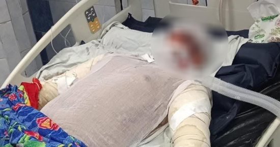 وفاة بطل حريق شبرا الخيمة متأثرا بإصاباته بحروق فى جميع أنحاء جسده