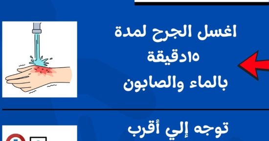 صحة كفر الشيخ: 12 مستشفى يستقبل مصابى عقر الحيوانات على مدار 24 ساعة