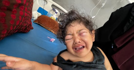 الطفلة حنين القصاص.. ضمور بالمخ يهدد حياتها مع استمرار الحرب فى غزة