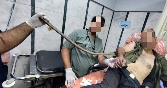 فريق جراحى بالتأمين الصحى ينقذ مريضا بعد اختراق سيخ حديدى لذراعه