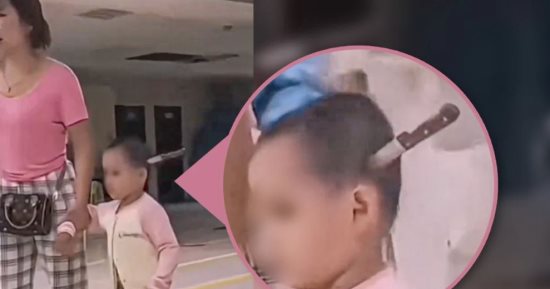 صور لسكين مغروس في جمجمة طفلة تثير الفزع.. والأم تصطحبها بـ هدوء للمستشفى