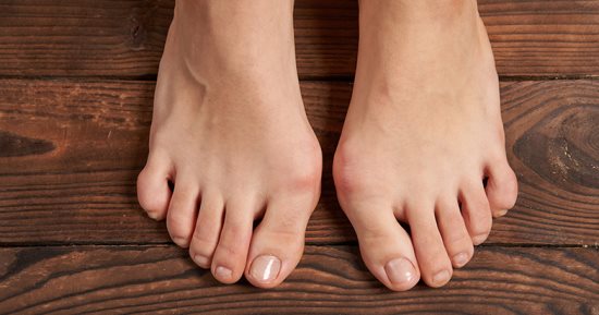 طرق طبيعية للتخلص من رائحة القدم الكريهة.. عشان ما تحسيش بالإحراج