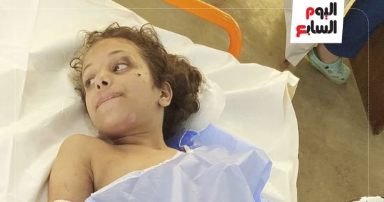 سبقتها أطرافها إلى الجنة.. مأساة طفلة تبحث عن علاج وسط قسوة الاحتلال