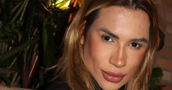  وفاة إنفلونسر برازيلى شهير بعد إجرائها.. ما هي جراحة عيون الثعلب ومخاطرها 