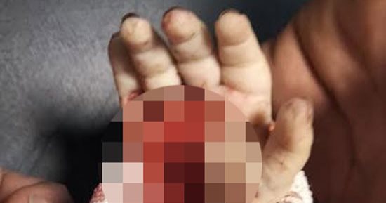 الطب الشرعى يفجر مفاجأة فى مصرع رضيعة بسوهاج بسبب عرسة 