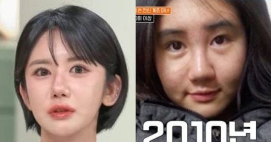 كورية جنوبية تجرى 400 عملية تجميل خلال 15 عاما
