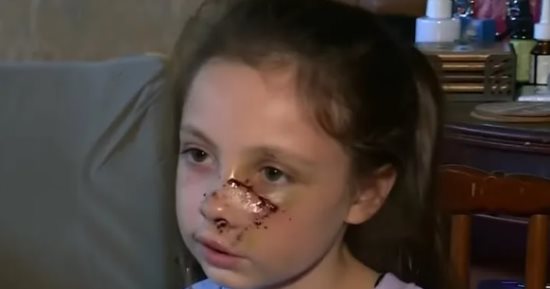 طفلة تتعرض لهجوم مروّع من كلب فى ألاباما.. جروح خطيرة وصدمة فى المجتمع المحلى