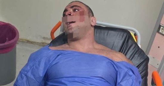 حبس المتهم بإصابة مدير صالة جيم بطلق نارى فى الشيخ زايد 4 أيام