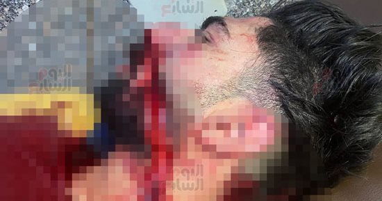 القبض على المتهمين بالاعتداء على شاب والشروع في قتله بالشرابية.. صور