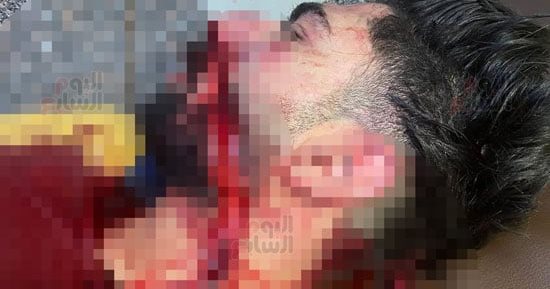شقيق ضحية الشرابية: الجناة اعتدوا عليه بأسلحة بيضاء في الشارع.. صور