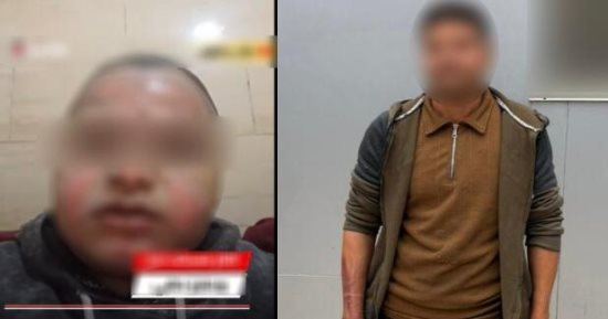 عامل بمحل حلوى يتعرض لحروق.. صاحب المحل يرفض العلاج والتحقيقات تكشف التفاصيل