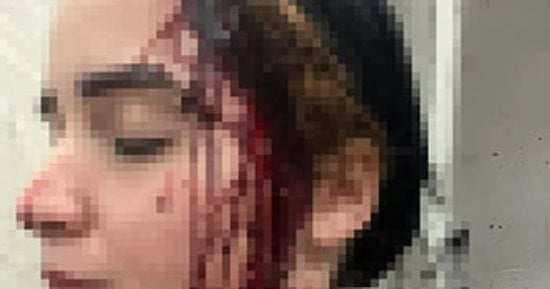 ضحية تشويه وجهها بالعجوزة: المتهم كان يمارس البلطجة ووجهت له تهمة استعراض القوة
