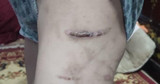 بلاغ يتهم زوجة أب بتعذيب نجل زوجها واحتجازه بالفيوم