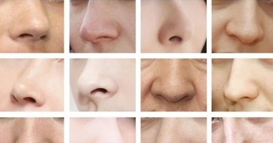 لماذا لا نمتلك نفس شكل الأنف؟.. أخصائى جراحة تجميل يجيب