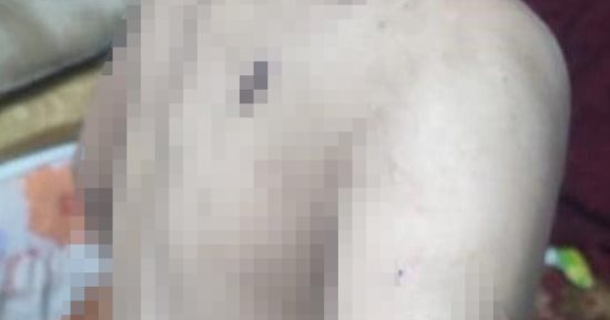 قلب حجر وسلخانة تعذيب.. زوجة أب تحول حياة طفل زوجها فى الفيوم إلى جحيم