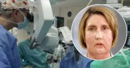 أول عملية زراعة وجه كامل من متبرعة تلقت الموت الرحيم تثير الجدل فى إسبانيا