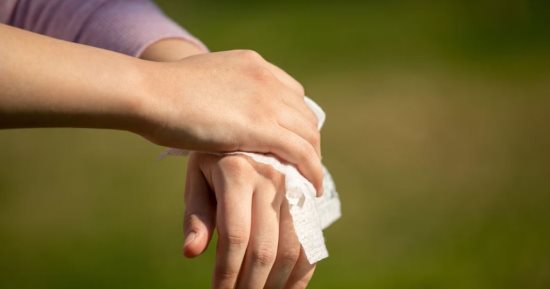 خبراء الصحة يحذرون من استخدام المناديل المبللة الخالية من الكحول على الجروح