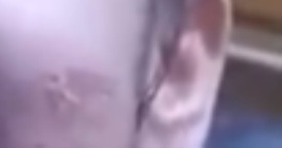 القبض على سيدة كوت ابنتها بشوكة ساخنة فى كفر الشيخ