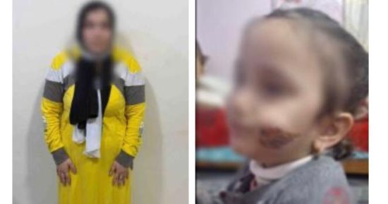 حرق فى الوجه عقابا على صلة الرحم.. كواليس صادمة لتعذيب أم لنجلتها