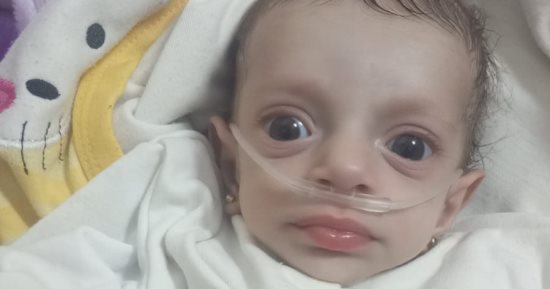 الطفلة ألما والحياة آلام.. حكاية رضيعة فلسطينية تعانى على أجهزة الأكسجين فى غزة.. ألما أبو ريدة تصارع المرض وتقاتل نقص الإمكانيات الطبية.. والدتها: نكافح من أجل فرصة حياة لابنتى حتى لا تتكرر مأساة فقدان شقيقتها