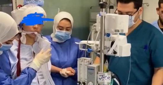 إنجاز طبى داخل قصر العينى.. فريق إيكمو ينقذ سيدة حامل من فشل تنقسى حاد
